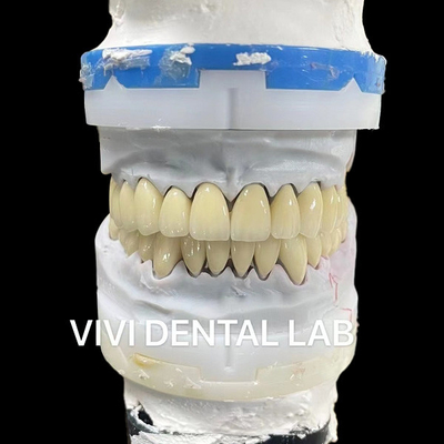 التاج الرقمي CAD CAM المختبر الأسنان الشفافة طبقة Zirconia التاج