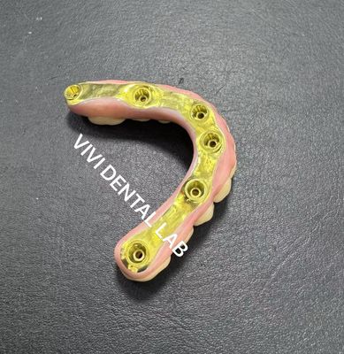 جسر زيركونيا كامل مع دعم شريط التيتانيوم