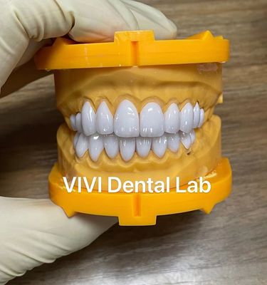 Ivoclar Emax Laminate Veneers High Translucency China Dental Lab