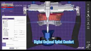 جبيرة الإطباق الرقمية راحة دقيقة