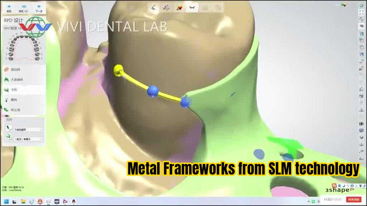 الصين VIVI DENTAI LABORATORY الشهادات